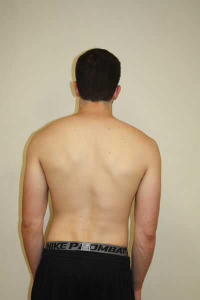 2-before-graham-physical-therapy-fitness-clinic-bethesda-md