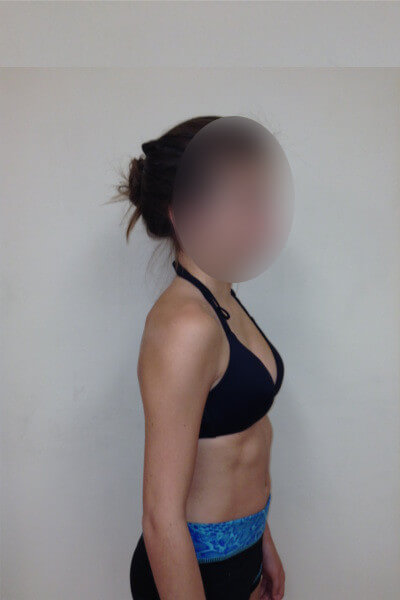 Before & After Photos