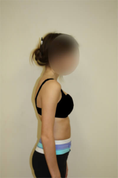 Before & After Photos