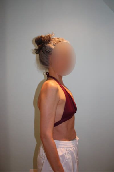 Before & After Photos