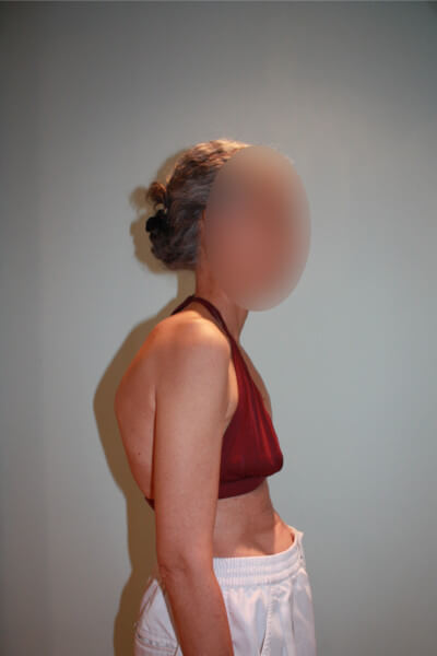 Before & After Photos