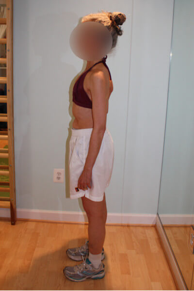 Before & After Photos