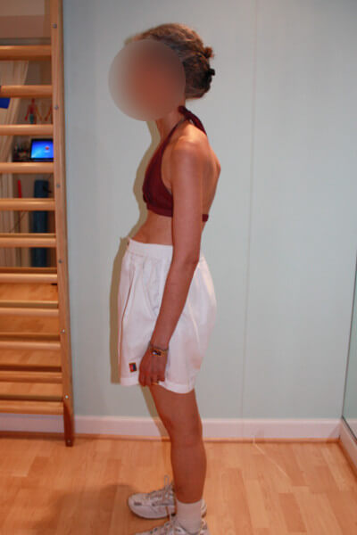 Before & After Photos