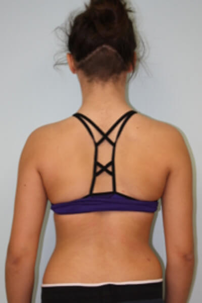 Before & After Photos