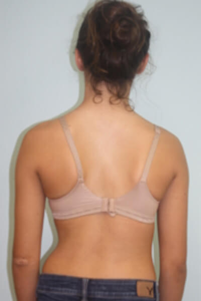 Before & After Photos